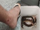Trabalhador é picado por jararaca durante almoço e leva serpente dentro de balde para o hospital em MS
