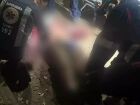 Rapaz tem artéria rompida e orelha dilacerada após ataque de 3 pitbulls em MS 