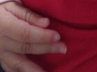Bebê de 7 meses é internado com costela quebrada e lesão no crânio; mãe é presa em MS