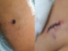 'Me afoguei no próprio sangue', diz sargento ferido em confronto policial em MS
