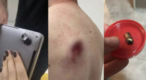 Homem é 'salvo' por notebook ao ser baleado durante assalto 