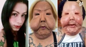 'É fácil você rir, porque a dor não tá em você': Juju do Pix fala pela primeira vez após cirurgia reparadora