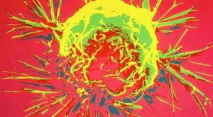 Muta&ccedil;&atilde;o ligada a c&acirc;ncer grave &eacute; transmitida por doador de s&ecirc;men a pelo menos 197 crian&ccedil;as 