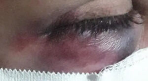 Agredida, manicure finge pedir rem&eacute;dio por telefone e filho aciona a pol&iacute;cia em MS