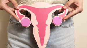 Conhe&ccedil;a os mitos sobre a s&iacute;ndrome do ov&aacute;rio polic&iacute;stico, que n&atilde;o &eacute; sin&ocirc;nimo de infertilidade
