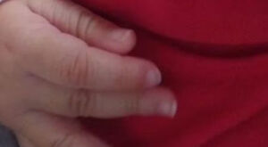 Beb&ecirc; de 7 meses &eacute; internado com costela quebrada e les&atilde;o no cr&acirc;nio; m&atilde;e &eacute; presa em MS