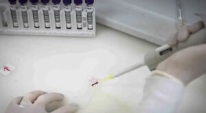 Secretaria de Sa&uacute;de de SP investiga novo caso suspeito de ebola