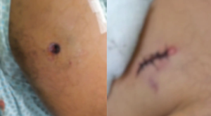 'Me afoguei no pr&oacute;prio sangue', diz sargento ferido em confronto policial em MS