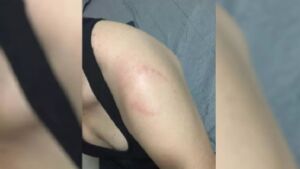 Mulher leva mordida após esbarrar em homem na academia; vídeo

