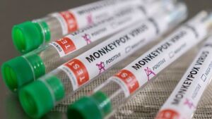 Novo caso suspeito de varíola dos macacos é notificado no Estado