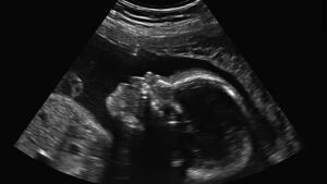 Adolescente asfixia e joga bebê prematuro no lixo ao forçar aborto

