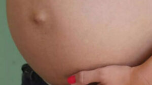 Bebê morre e família denuncia negligência na demora de parto em MS