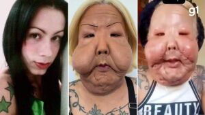 'É fácil você rir, porque a dor não tá em você': Juju do Pix fala pela primeira vez após cirurgia reparadora