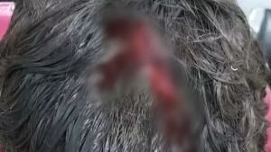 Dupla envolvida em tentativa de homicídio em Sonora é apreendida 