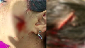 Homem ataca e rasga cabeça de mulher durante festa de 1 ano do filho
