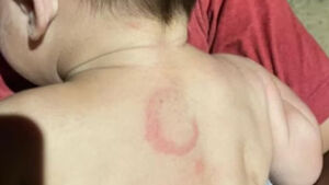 Pai acusado de espancar bebê de quatro meses tem prisão mantida em MS