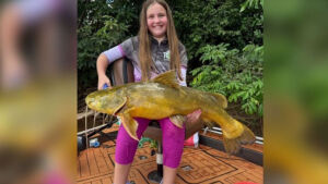 Menina de 11 anos encara 