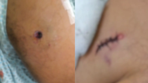 'Me afoguei no próprio sangue', diz sargento ferido em confronto policial em MS