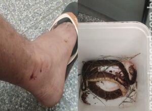Trabalhador é picado por jararaca durante almoço e leva serpente dentro de balde para o hospital em MS