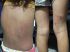 Crianças tinham várias marcas de agressões pelo corpo. Foto: Reprodução