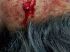 Vítima foi baleada de raspão no pescoço. Foto: Rede social