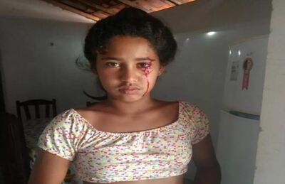 Menina de 12 anos sangra pelos olhos e assusta família no Norte do Piauí 