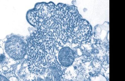 Partículas de vírus Nipah isolados da amostra de líquido cefalorraquidiano de uma pessoa infectado 