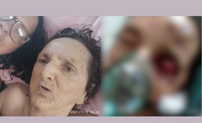 À esquerda foto mostra idosa em dia que estava prestes a receber alta; à esquerda mostra situação de idosa após o armário de hospital despencar. 