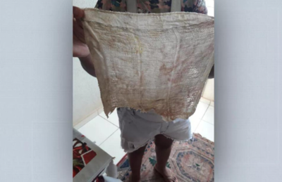 Mulher passa quase seis meses com pedaço de pano dentro de ânus após cesárea em Ribeirão Preto (SP) 