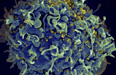 letromicrografia mostra HIV infectando célula humana