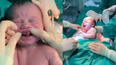 Arthur nasceu com seis dentinhos, em maternidade de Campo Grande.