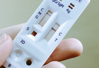 Testes rápidos estarão disponíveis em unidades da rede pública de saúde 