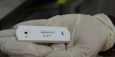 Teste rápido de HIV, feito com pequena amostra de sangue.