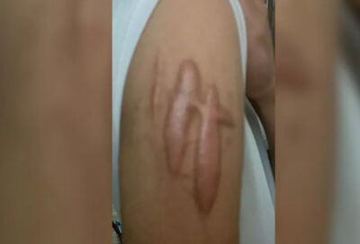Parte do corpo onde adolescente sofreu corte de caco de vidro, a mando do pai de santo. (Reprodução: Fala Povo)