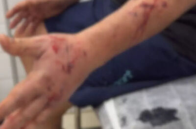 O ataque ocorreu enquanto o professor caminhava com a sua cachorra. (Fala Povo)