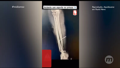 Foto: Reprodução/ Aquidauana em Pauta