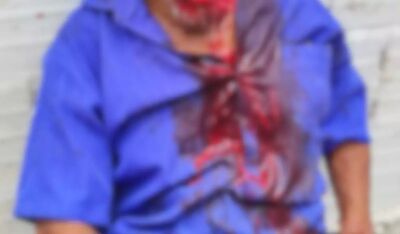 O idoso ficou 'lavado' de sangue após o ataque. Foto: Divulgação