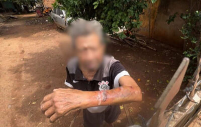 Braço da vítima ficou bastante machucado. (Foto: Leonardo de França, Midiamax)