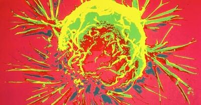 Uma célula de câncer, fotografada por um microscópio eletrônico de varredura, que produz imagens tridimensionais. Foto: NIH/Domínio Público