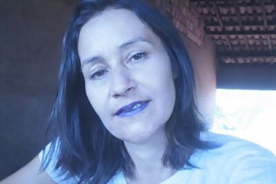 Janete ficou com faca cravada no peito.Foto: Reprodução/Redes Sociais