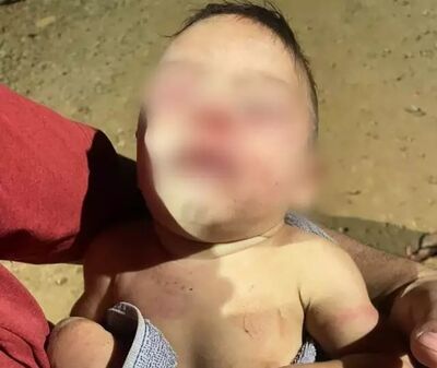 Bêbe com diversas lesões pelo corpo. Foto: Reprodução/CGNEWS 