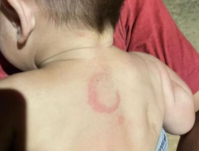 O bebê de 4 meses está internado na Santa Casa de Campo Grande.  Foto: Reprodução