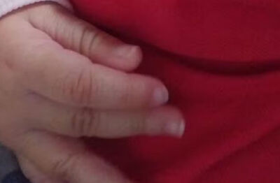Mãe é presa após bebê de 7 meses ser internado com lesões graves em MS  Foto: Arquivo