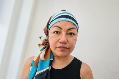 Zuleide durante o tratamento contra o câncer. Foto: Arquivo pessoal