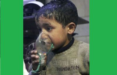 Crianças são atendidas após suposto ataque químico na Síria