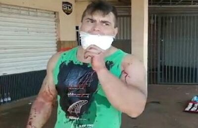 Ciclista ferido é um rapaz de 23 anos; ele recusou atendimento