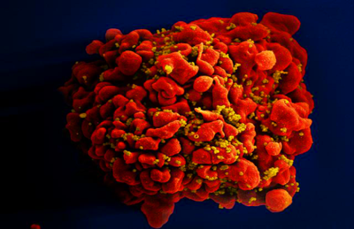 Célula infectada por partículas do vírus HIV, anexas à superfície