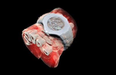 Uma imagem de um raio x colorido e em 3D de um pulso com um relógio que mostra a parte dos ossos do dedo em branco e tecido macio em vermelho