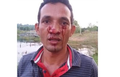 Moisés Rodrigues foi atacado no rosto por sucuri de 3 metros
