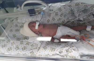 Laura na incubadora, logo após o nascimento